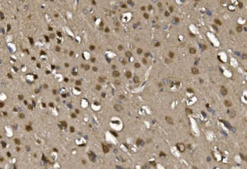 Anti-MEF2C Antibody