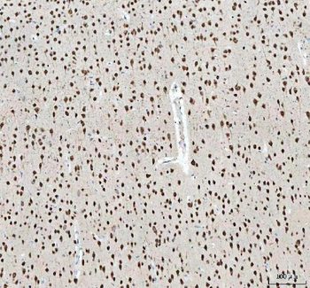 Anti-Nova1 Antibody