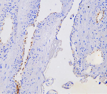 Anti-Nova1 Antibody