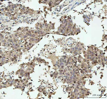 Anti-Nova1 Antibody