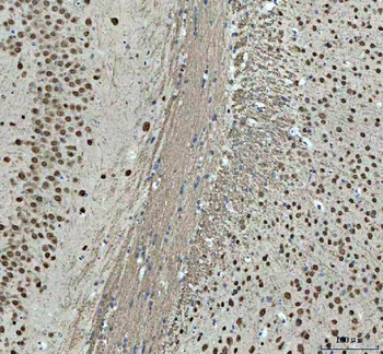Anti-Nova1 Antibody