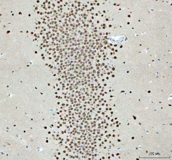 Anti-Nova1 Antibody