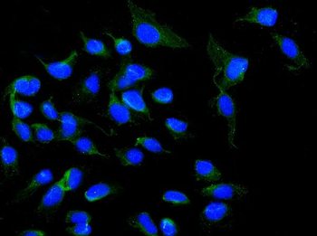 Anti-NOX5 Antibody