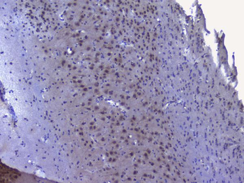 Anti-NRF1 Antibody