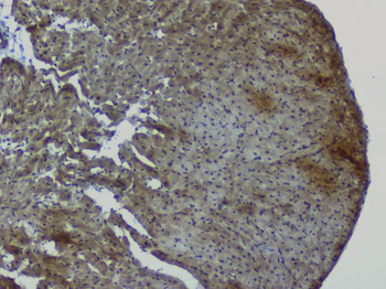 Anti-NRF1 Antibody