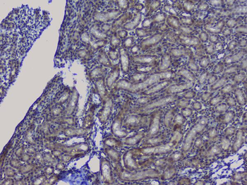 Anti-NRF1 Antibody