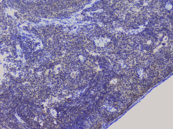 Anti-NRF1 Antibody