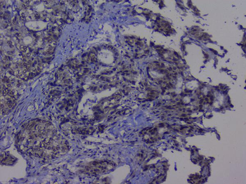 Anti-NRF1 Antibody