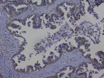 Anti-NRF1 Antibody