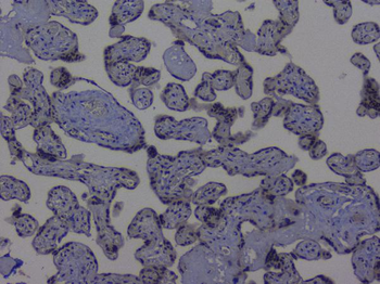 Anti-NRF1 Antibody