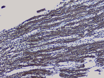 Anti-NRF1 Antibody