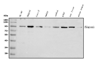 Anti-Plasminogen/PLG Antibody