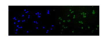 Anti-Rad51 Antibody