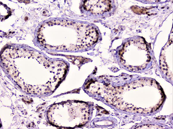 Anti-Rad51 Antibody