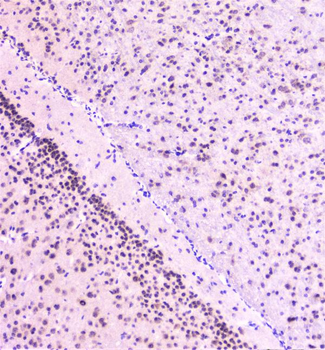 Anti-Rad51 Antibody