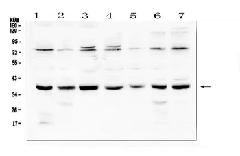 Anti-Rad51 Antibody