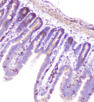 Anti-RASAL1/RASAL1 Antibody