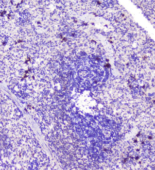 Anti-RASAL1/RASAL1 Antibody