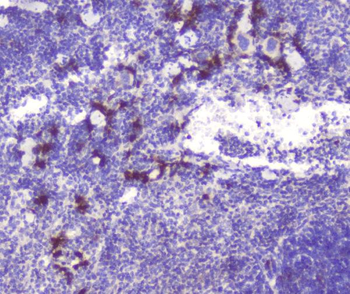 Anti-RASAL1/RASAL1 Antibody