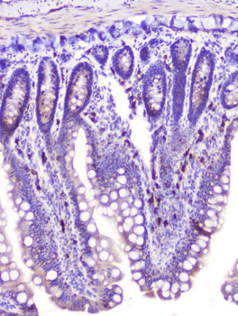 Anti-RASAL1/RASAL1 Antibody