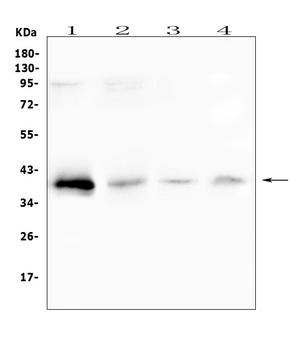 Anti-RP2 Antibody