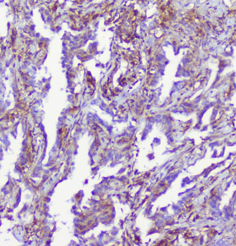 Anti-RP2 Antibody
