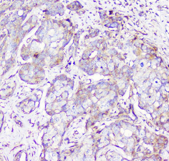 Anti-RP2 Antibody