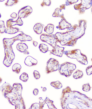 Anti-RP2 Antibody