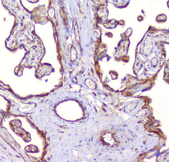 Anti-RP2 Antibody