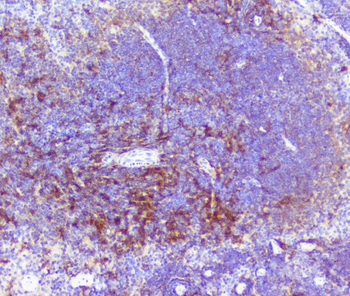 Anti-RP2 Antibody