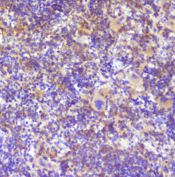 Anti-RP2 Antibody
