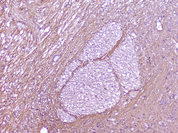Anti-SNAP25 Antibody