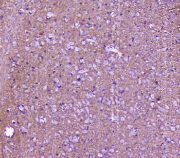 Anti-SNAP25 Antibody