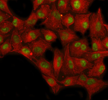 Anti-SP1 Antibody