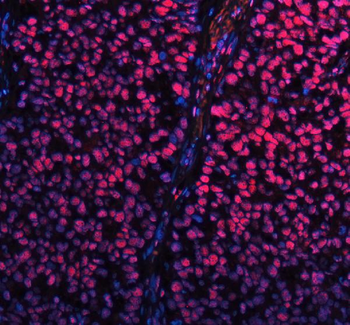 Anti-SP1 Antibody