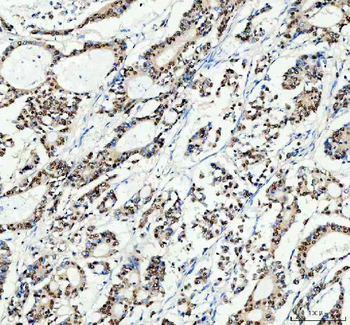 Anti-SP1 Antibody