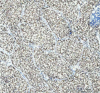 Anti-SP1 Antibody