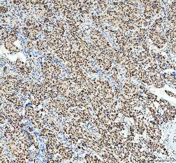 Anti-SP1 Antibody