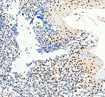 Anti-SP1 Antibody