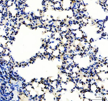 Anti-SP1 Antibody