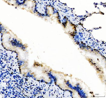 Anti-SP1 Antibody