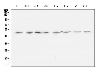 Anti-TANK Antibody