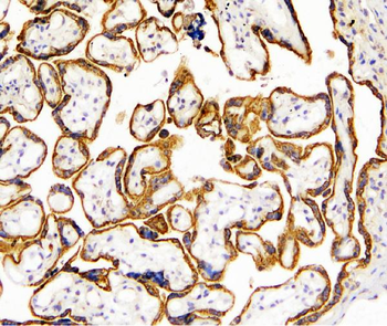 Anti-TANK Antibody