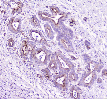 Anti-TANK Antibody