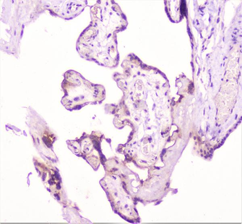 Anti-TANK Antibody