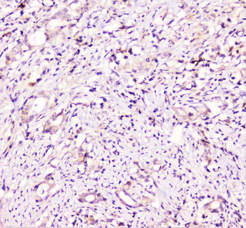 Anti-TANK Antibody