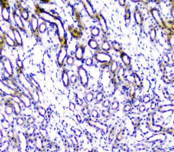 Anti-TANK Antibody