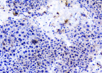 Anti-TANK Antibody