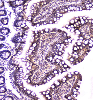 Anti-TANK Antibody