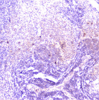 Anti-TANK Antibody